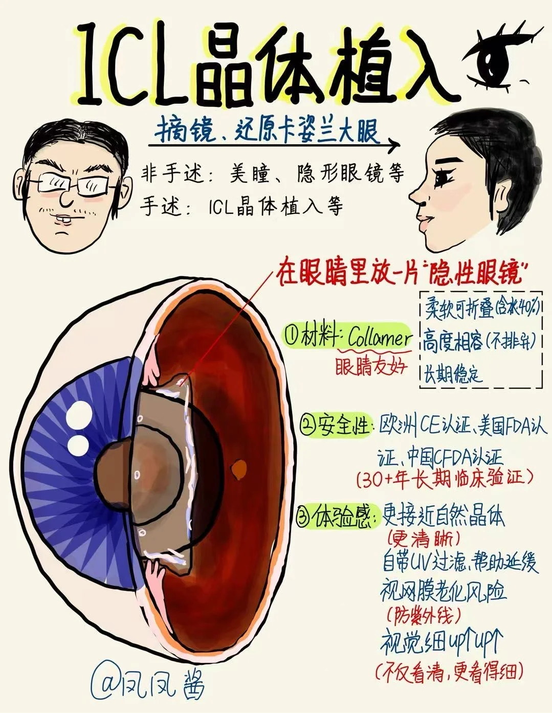 📖手绘笔记｜ICL晶体植入 建议点赞收藏🔥