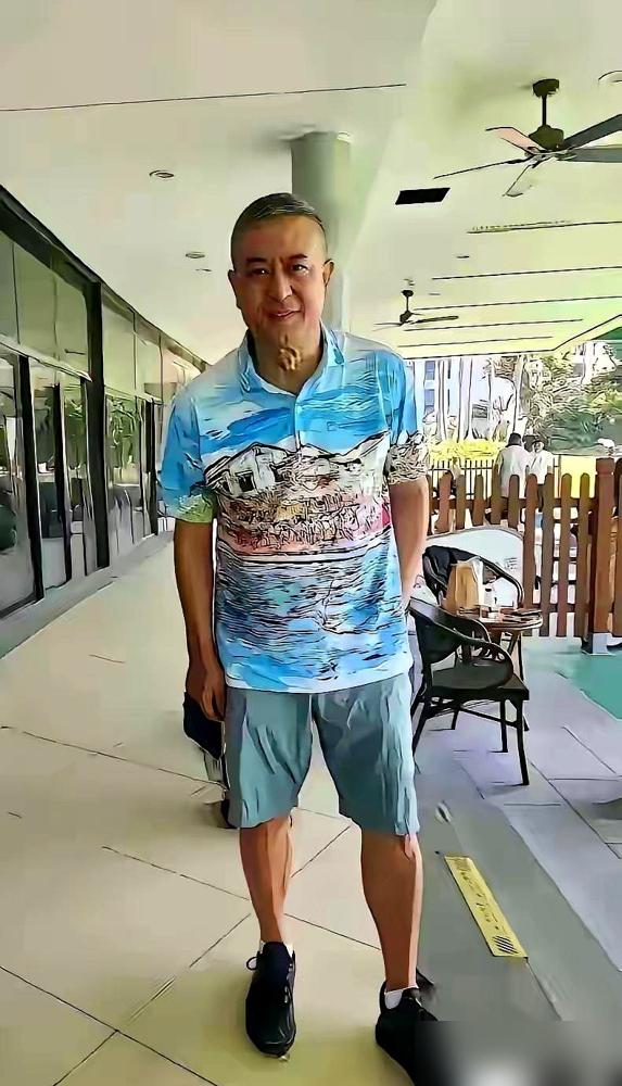 张嘉译的强直性脊柱炎，已经缠了他快30年。
原本1米78的个子，现在看起来才1