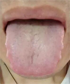 “进补”非良策，脾阳虚、寒湿重进补需谨慎
面对这类患者，我有时会感到十分挫败。因