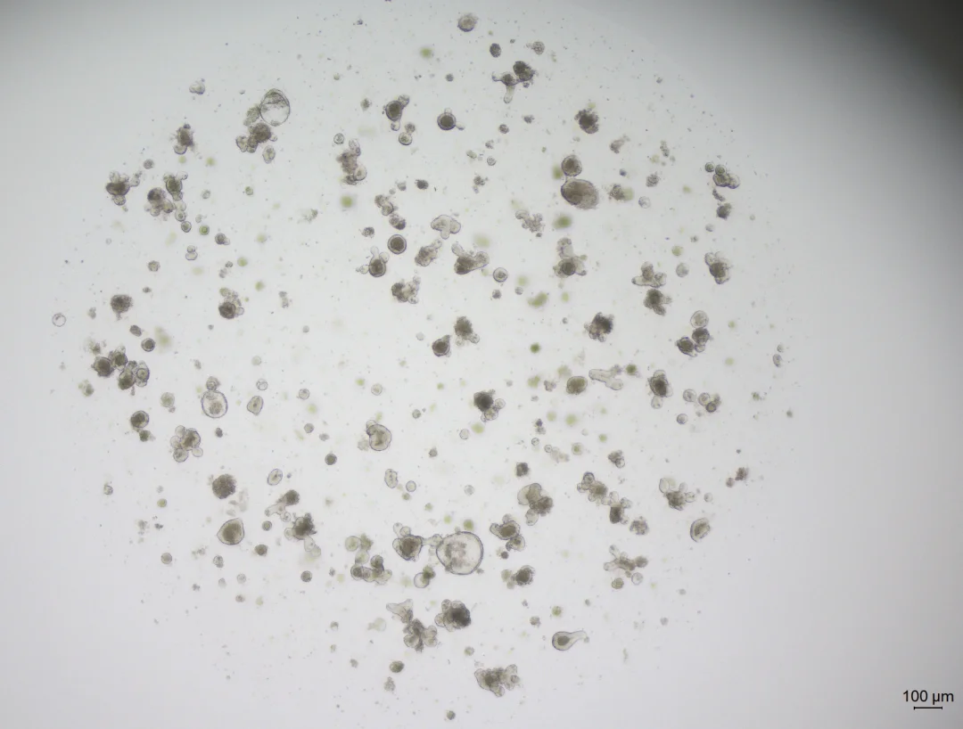 小鼠小肠类器官传代第二天