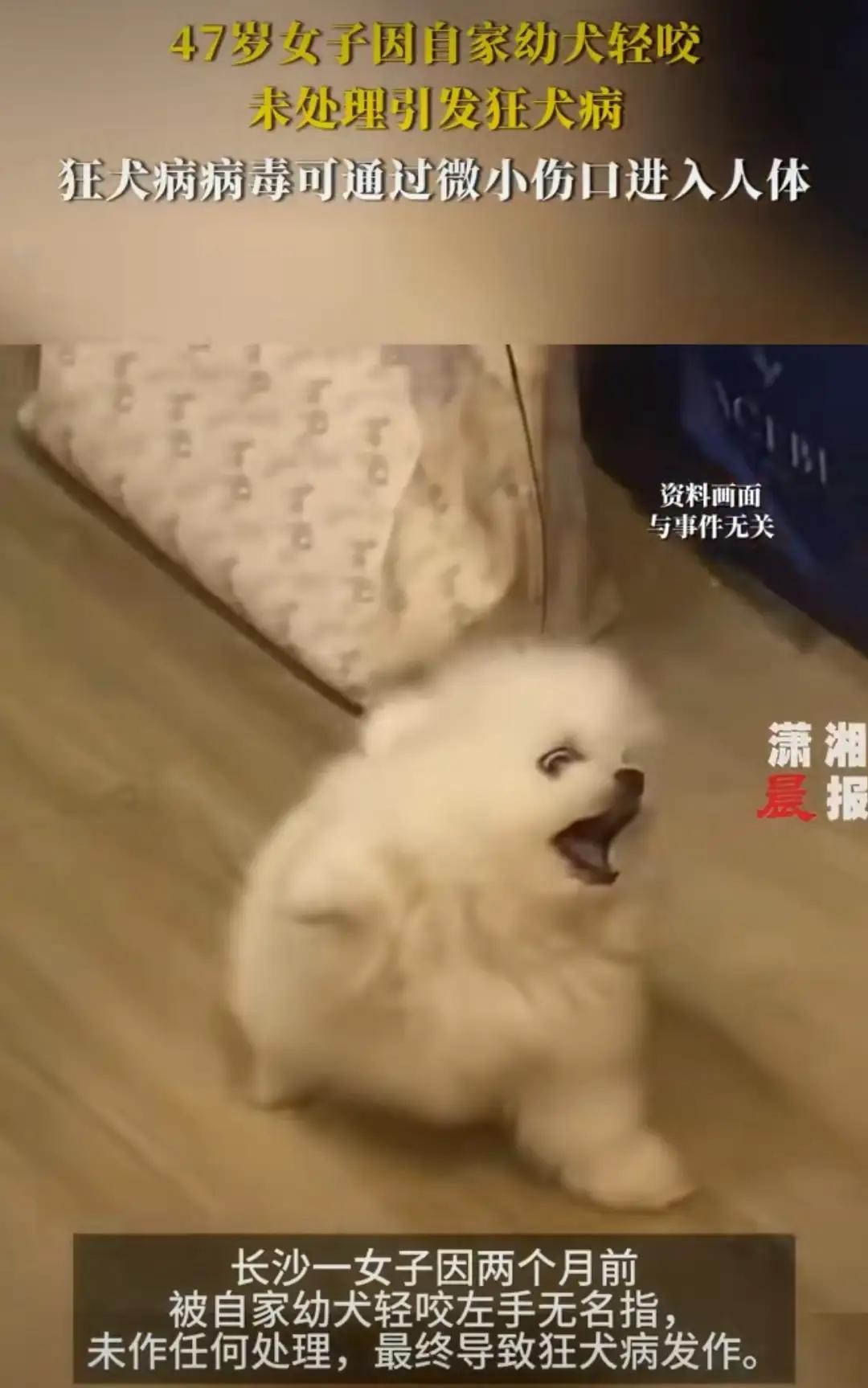 养狗人士注意:自家狗咬伤，也有狂吠病发作的可能。                