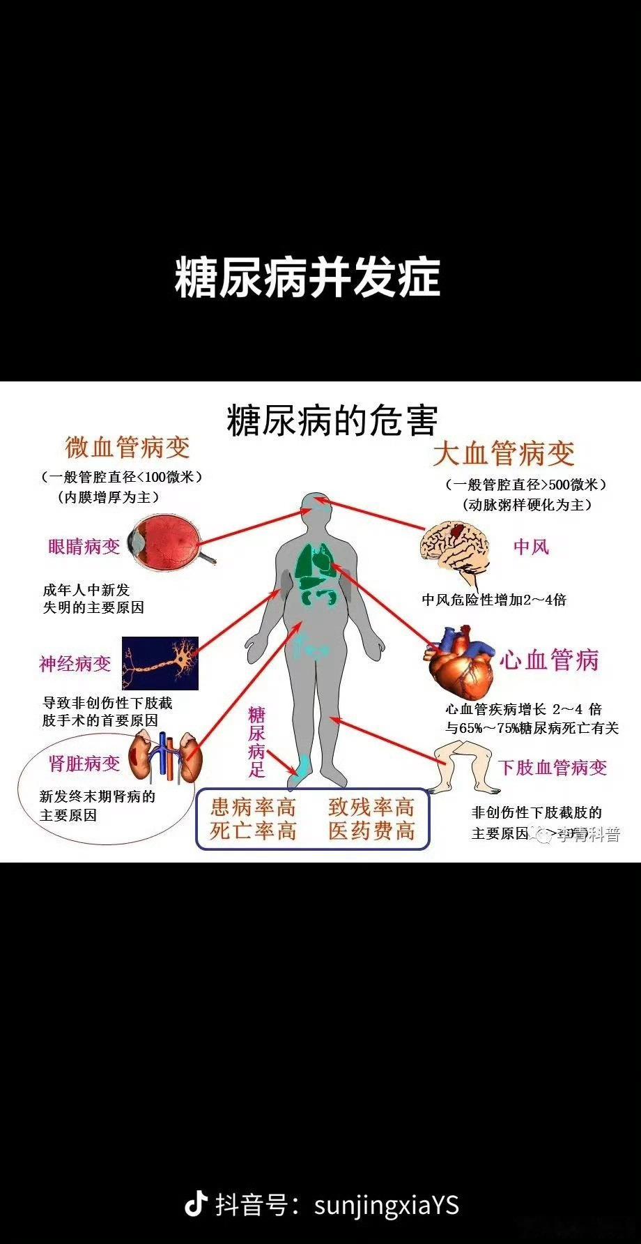 糖尿病 年轻化现在疾病与年龄无关，年轻人现在压力大，也容易出现身体恶化，经常熬夜