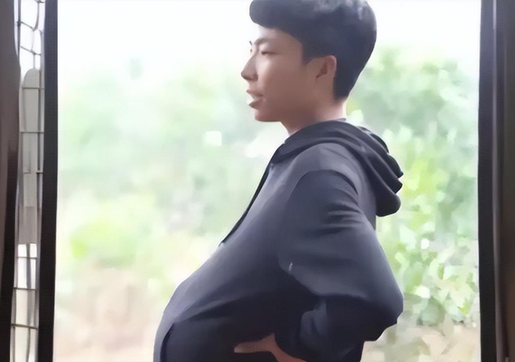 2003年，重庆小伙肚子异常大，被村里人嘲笑怀孕，手术后，男子真生下18斤的“女