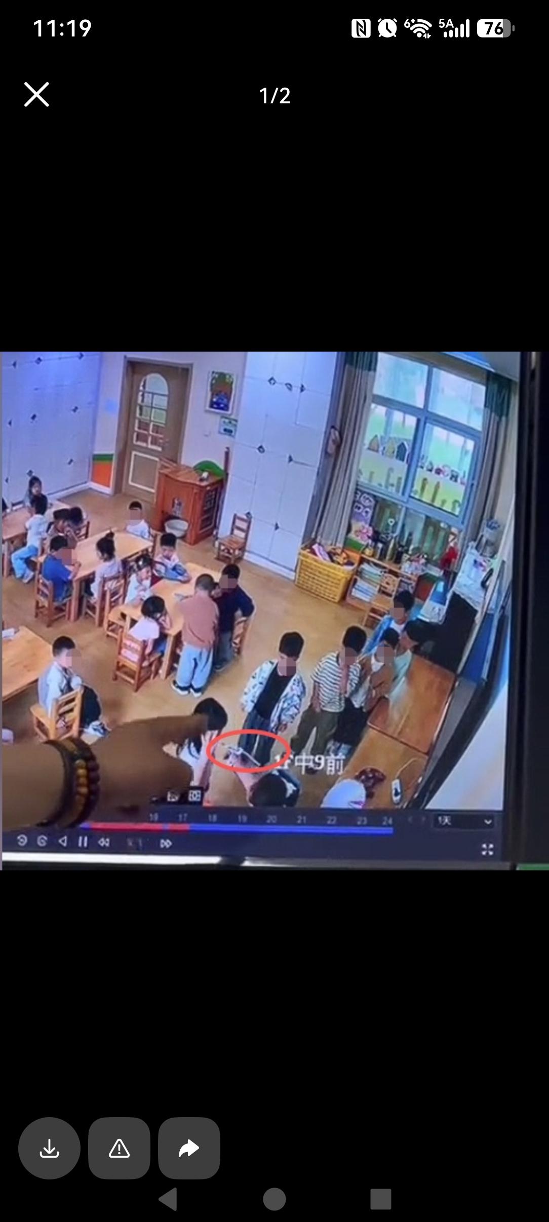 哪个家长也受不了？徐州丰县一女孩在幼儿园被老师陈某捏着嘴巴，用热熔枪烫了两次！孩