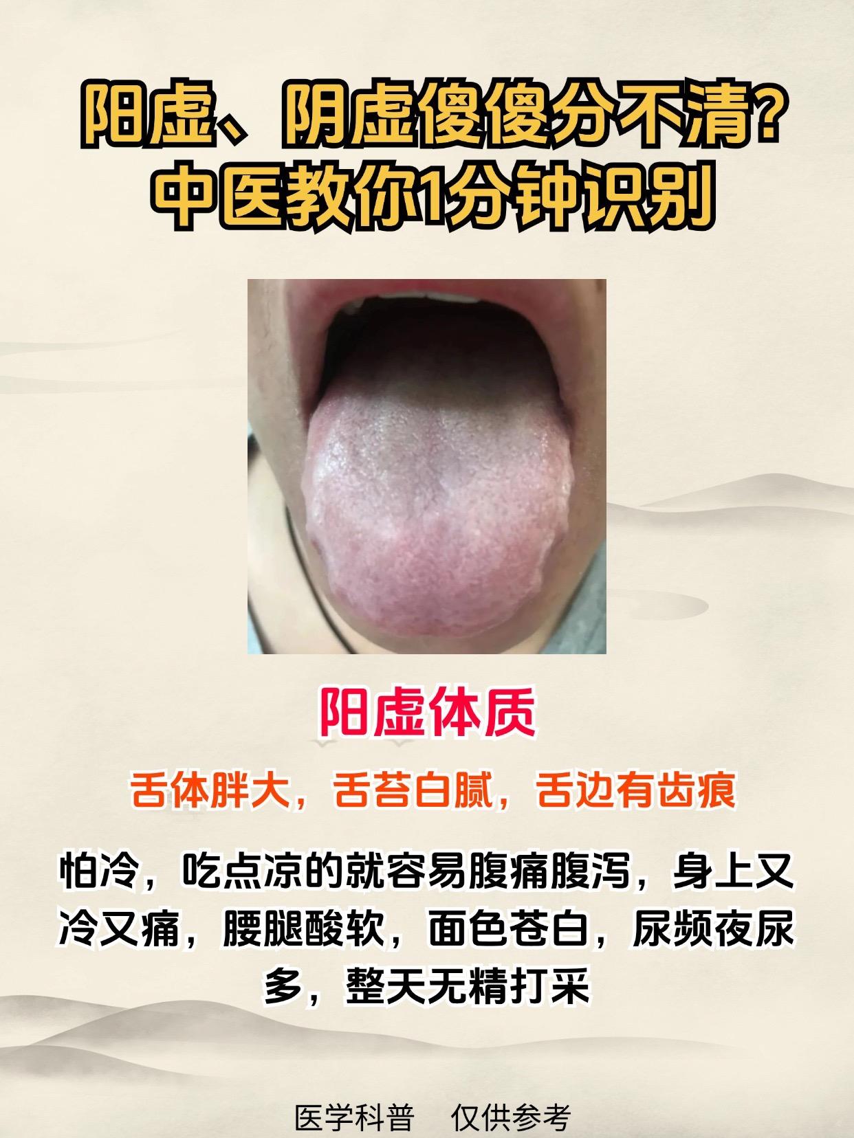 阳虚，阴虚分不清？中医教你一招，仅需一分钟，快速识别！

#健康##中医#
