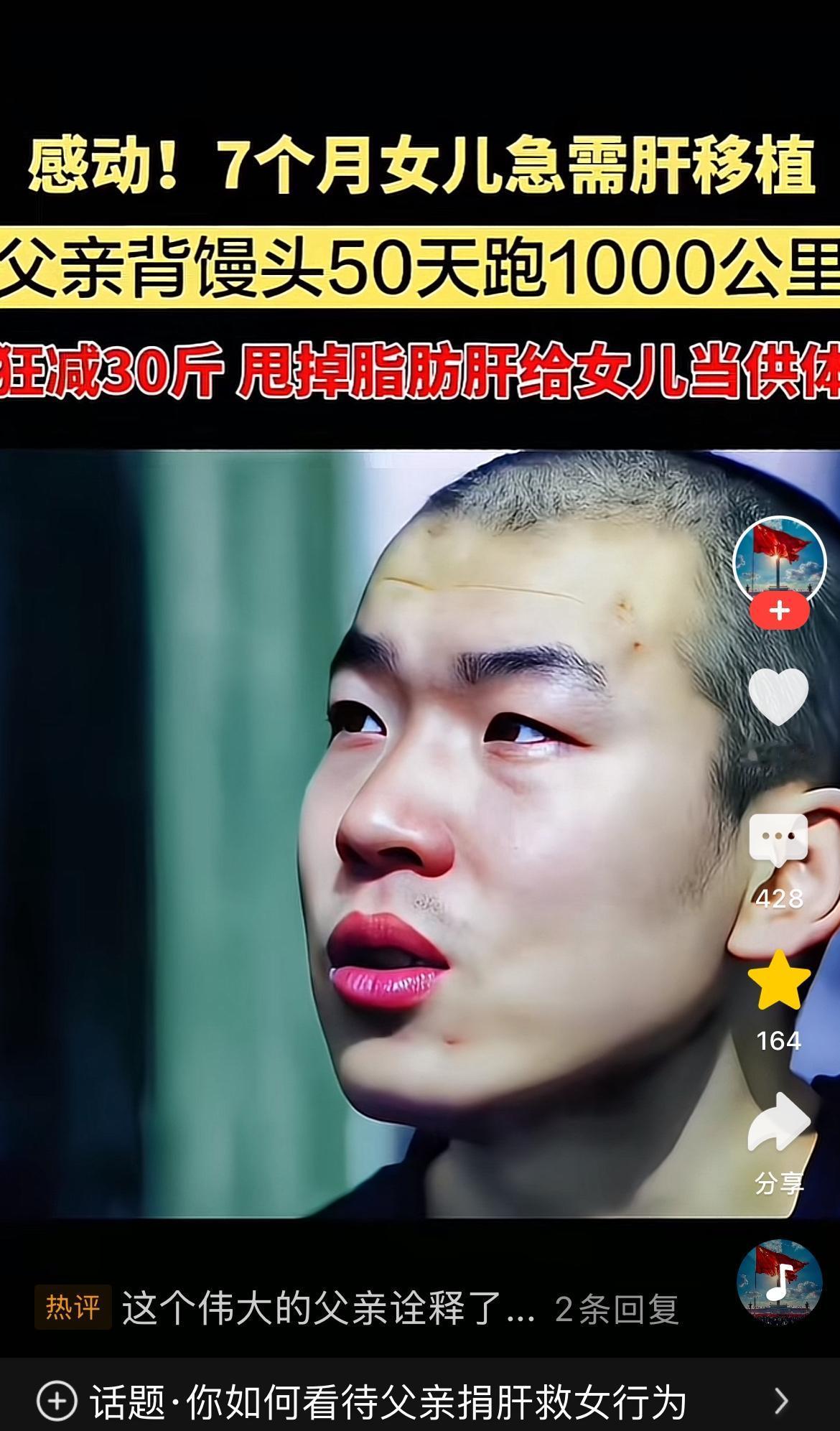 这张照片里的父亲叫宋宏磊，大家都叫他“馒头哥”。为了救7个月大的女儿，他用50天