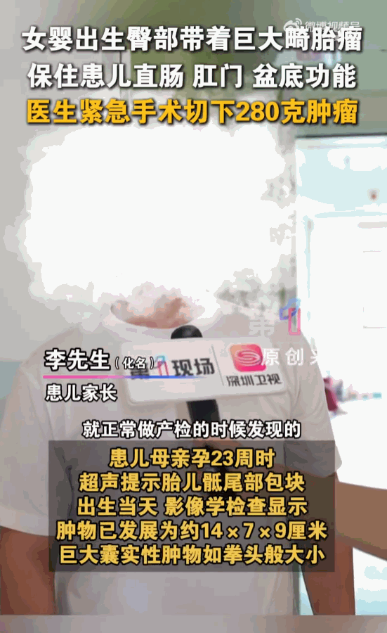 人心都是肉长的！广东深圳，一个刚出生仅数小时的娇嫩女婴，臀部竟然挂着一个比拳头还