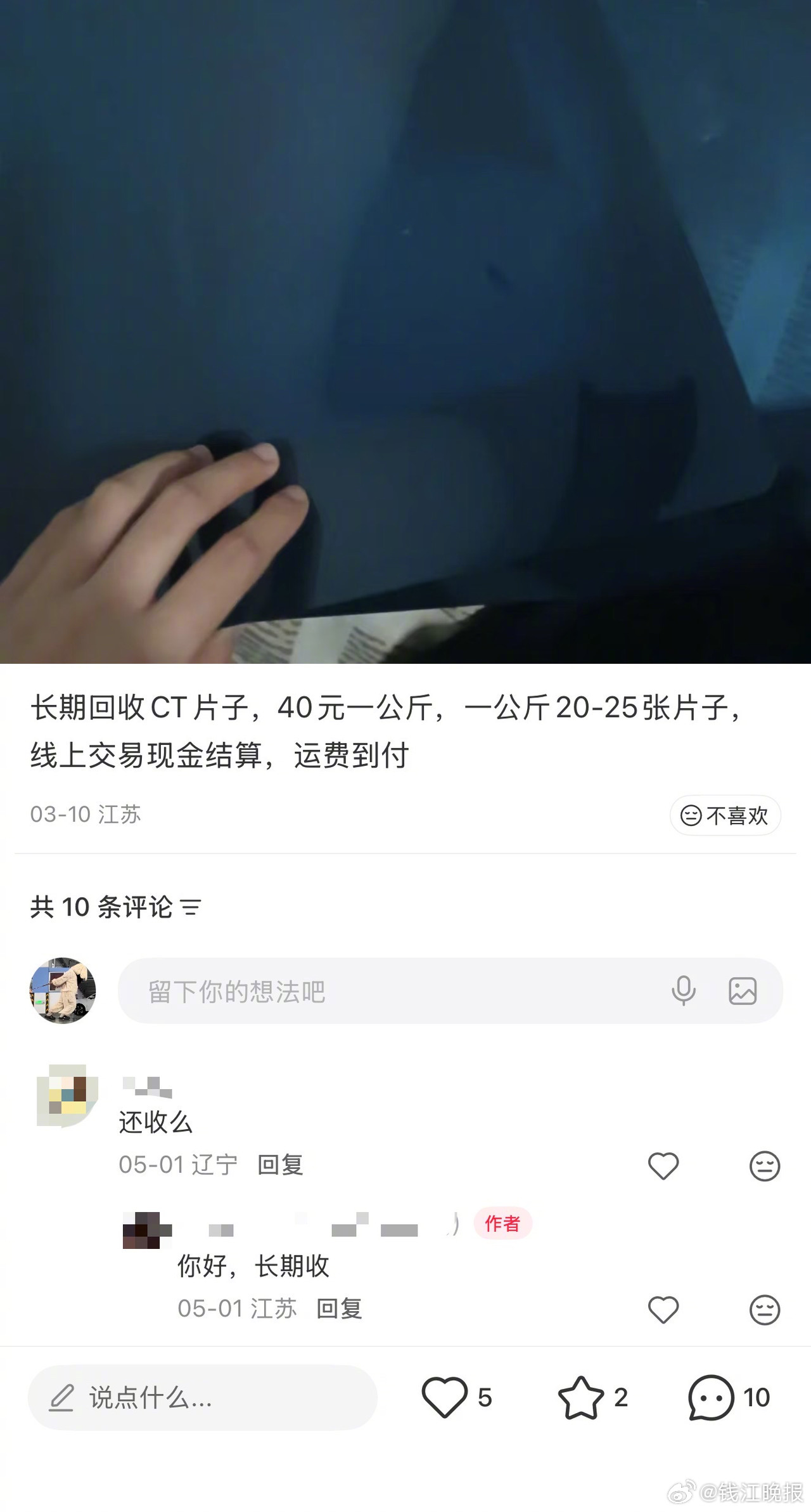 【#银价带火CT胶片回收律师紧急提醒# ：擅自收集提炼，涉嫌违法！】去年年底以来