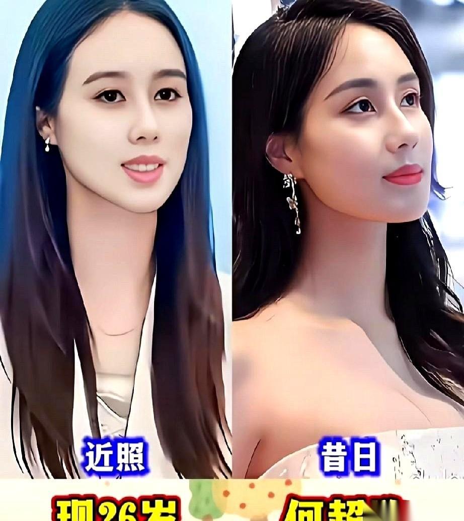 赌王何鸿燊的大女儿何超英，67岁走的，照片上那张脸，却皱得像80岁。
她出生就攥