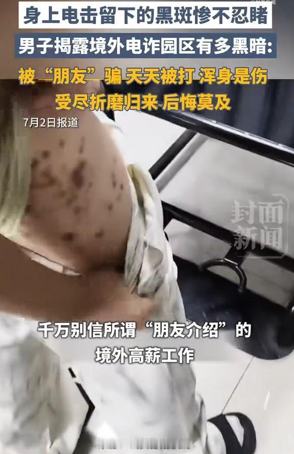 男子在柬埔寨被两次转卖惨不忍睹，该男子是被朋友骗过去从事“高薪工作”，没想到，钱