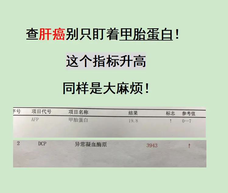 山东德州的肝硬化患者在当地检查做彩超检查出一个3公分左右的结节诶，但是...