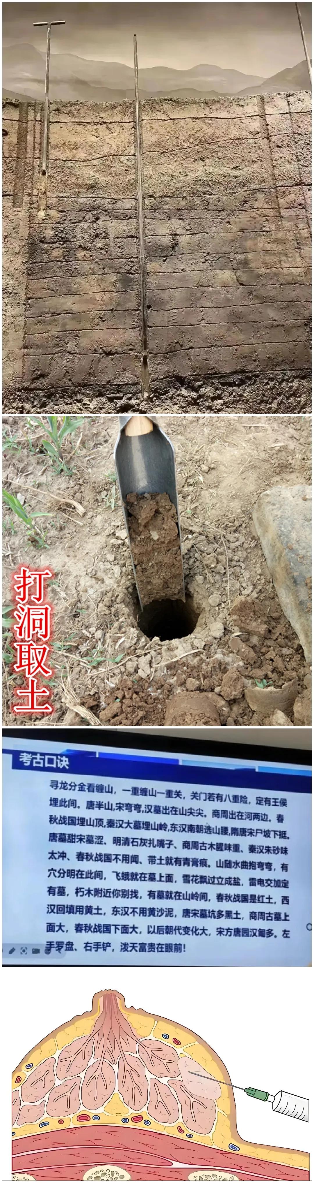 洛阳铲！[发怒]
个头虽小，本事很大！

这东西结构简单，造价便宜，前面就是一个