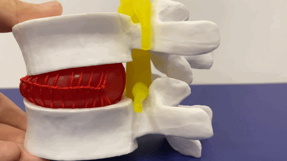 腰痛 一张图帮你理解——为啥错误的往前弯腰，会增加腰突风险？转给总是弯腰搬东西，