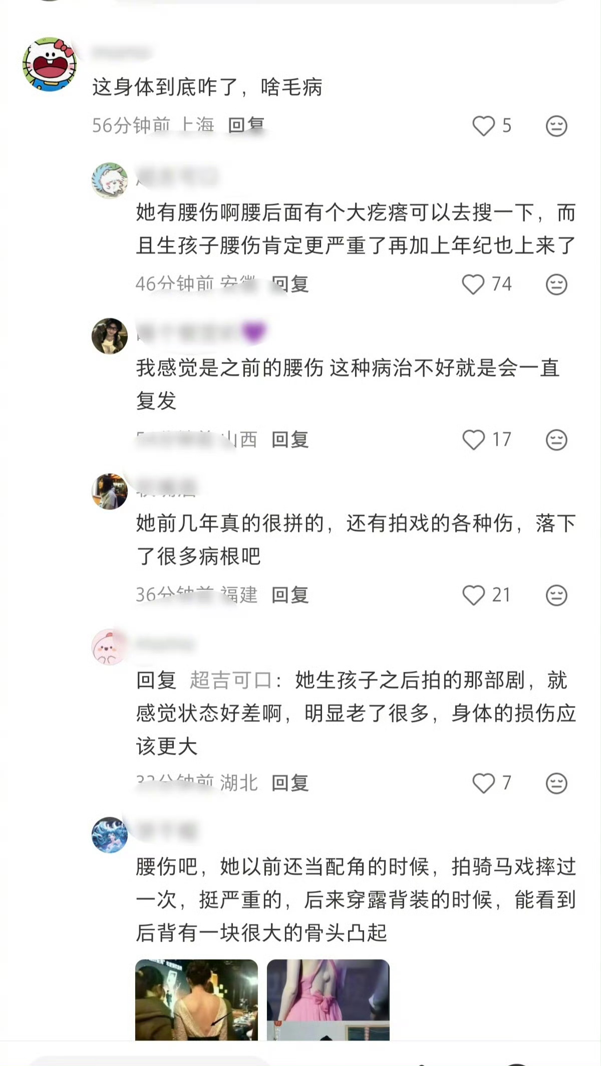 赵丽颖的近况 安心休养，好好养伤，注意身体，期待之后的新作。 ​​​
