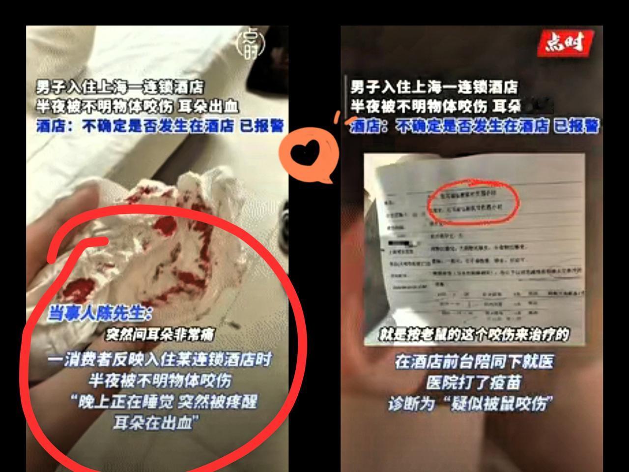 “倒大霉了！”上海一男子半夜在酒店休息时，突然感觉有东西在咬他耳朵，男子猛地张开