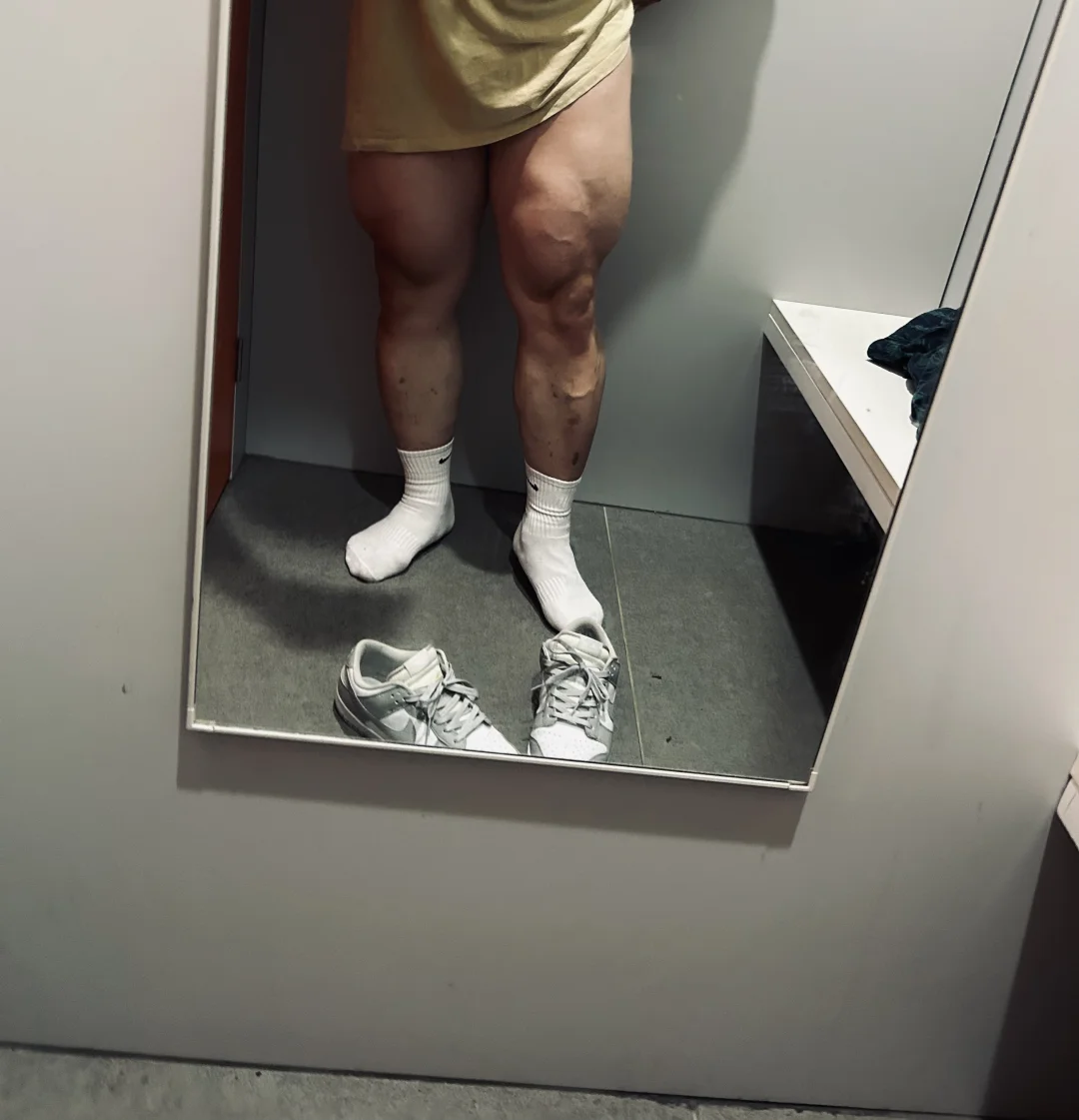 腿🦵🏻