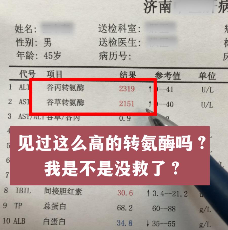 今天门诊太让人生气了！45岁的德州大兄弟，转氨酶升高到2000多了才来...