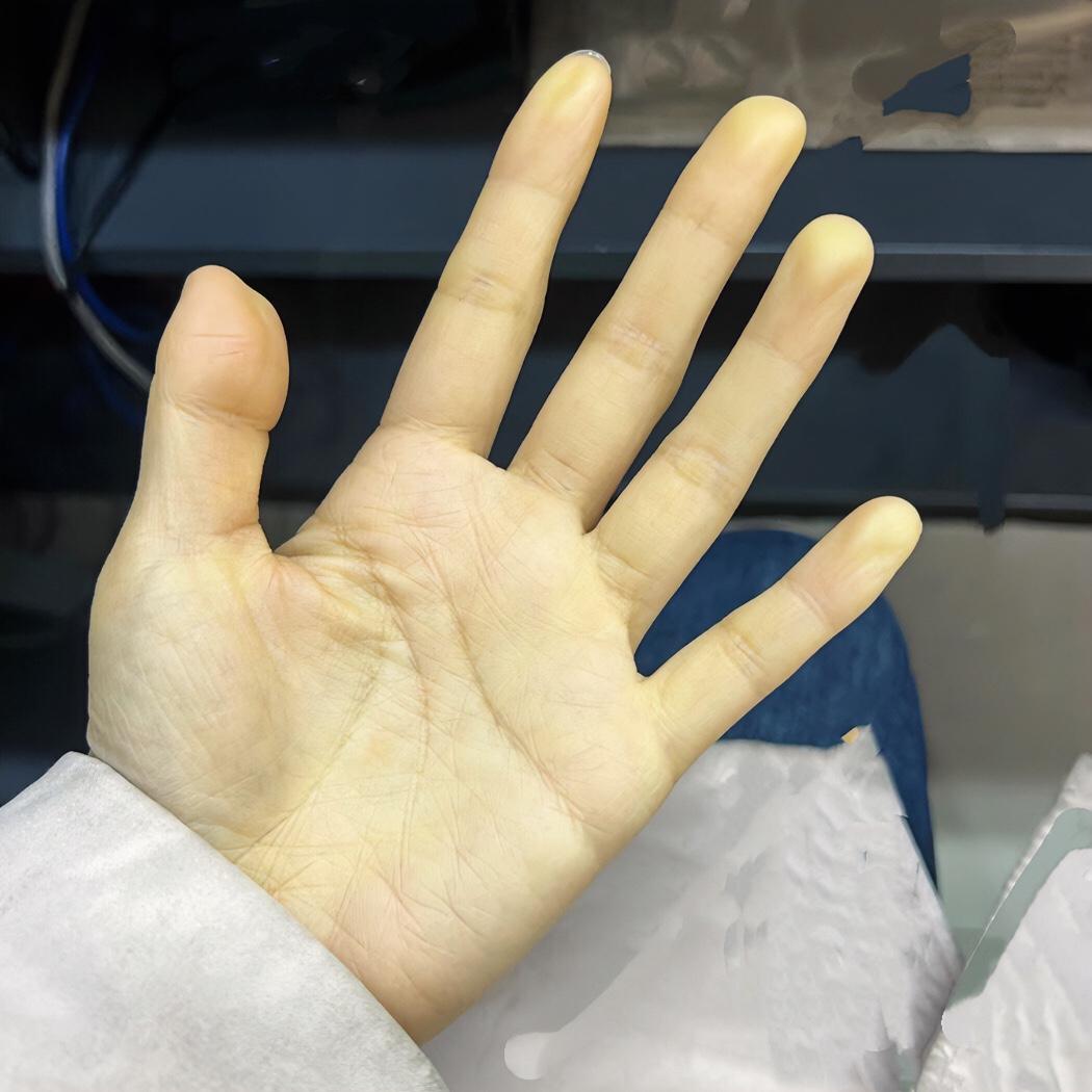 这手的黄是正常吗