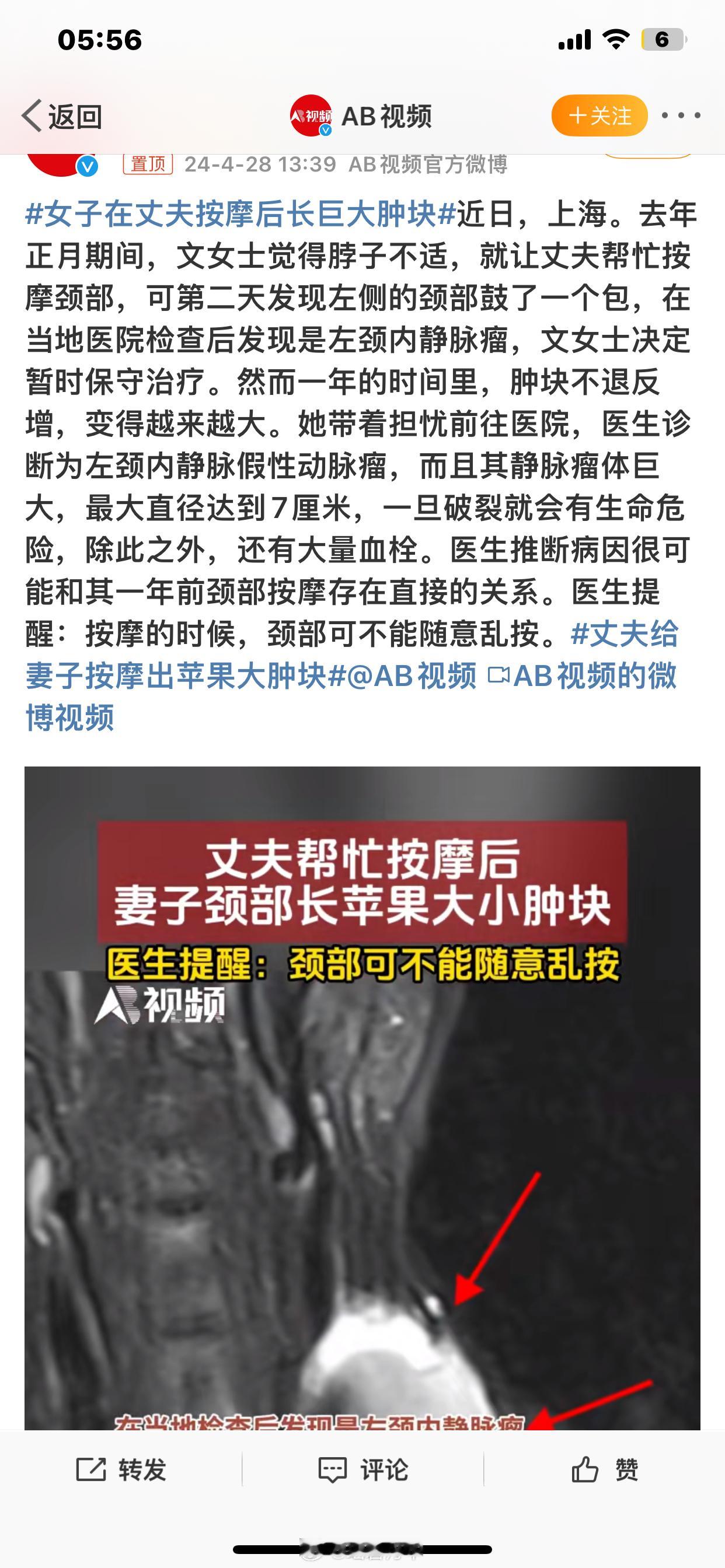 #女子在丈夫按摩后长巨大肿块#很多人不舒服去医院看病，各种失眠多梦等都找不到原因