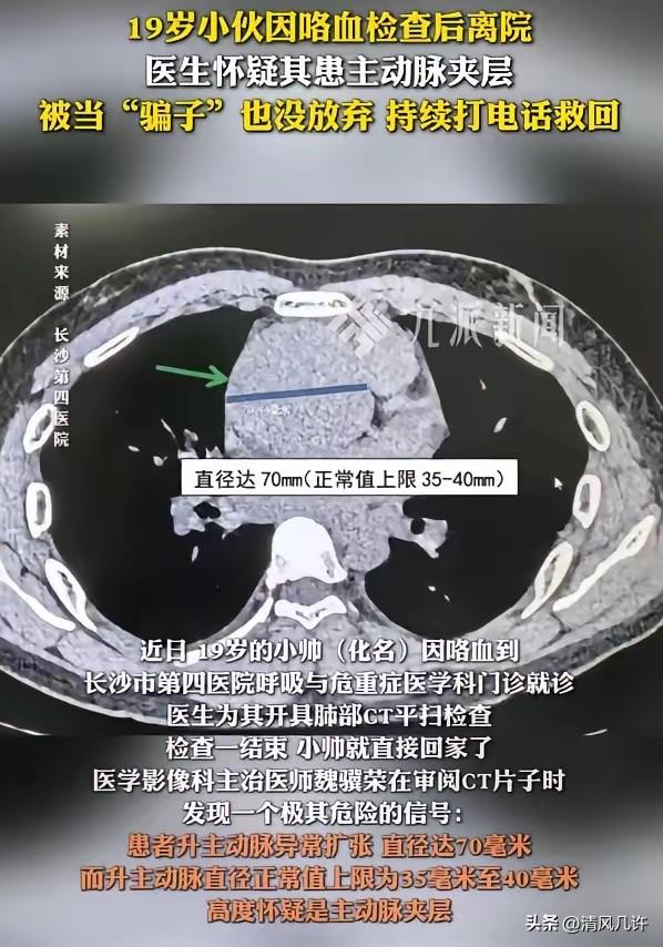 这位医生火了！湖南长沙，一名19岁小伙在家中咯血，随后立刻去医院做了检查，谁知拍