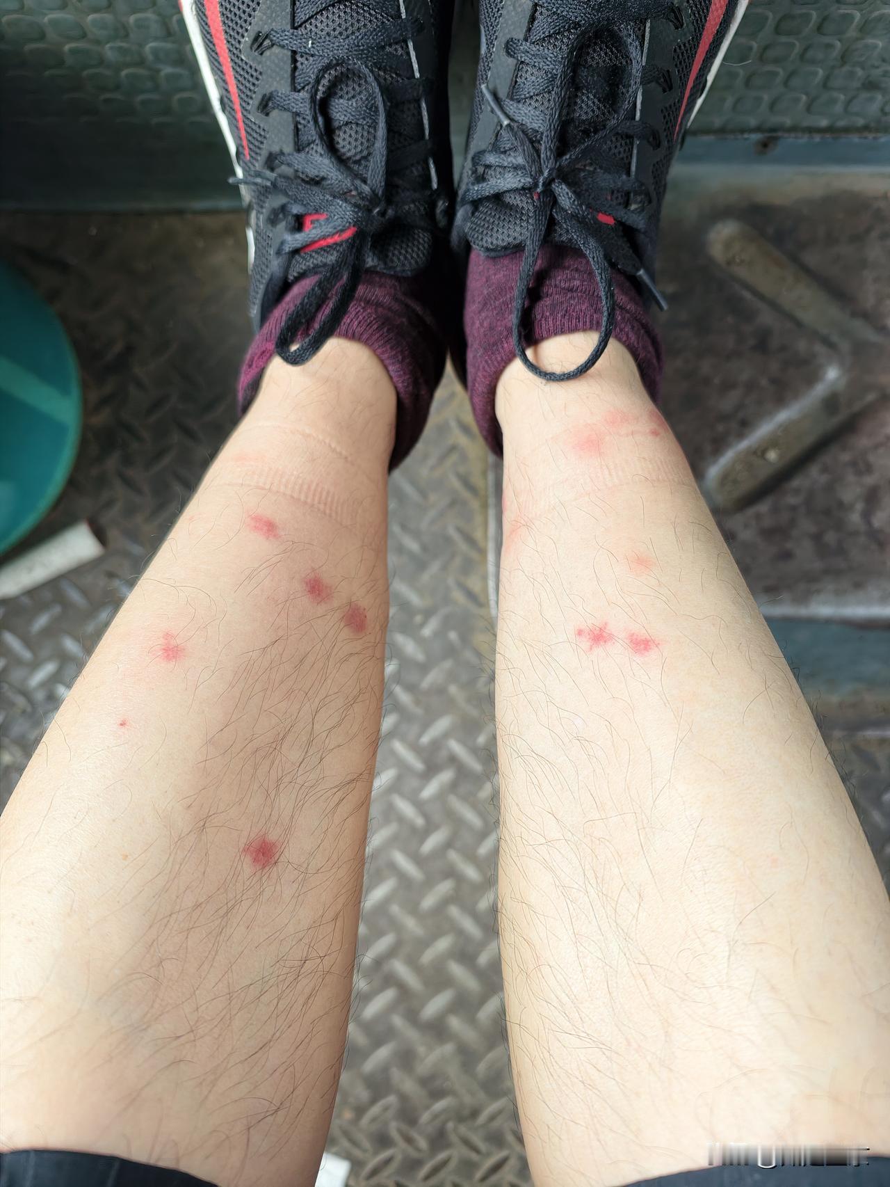 山里的蚊子攻击性太猛了，隔着衣服叮人，双腿惨不忍睹…
 
回辽宁大连农村，到山里
