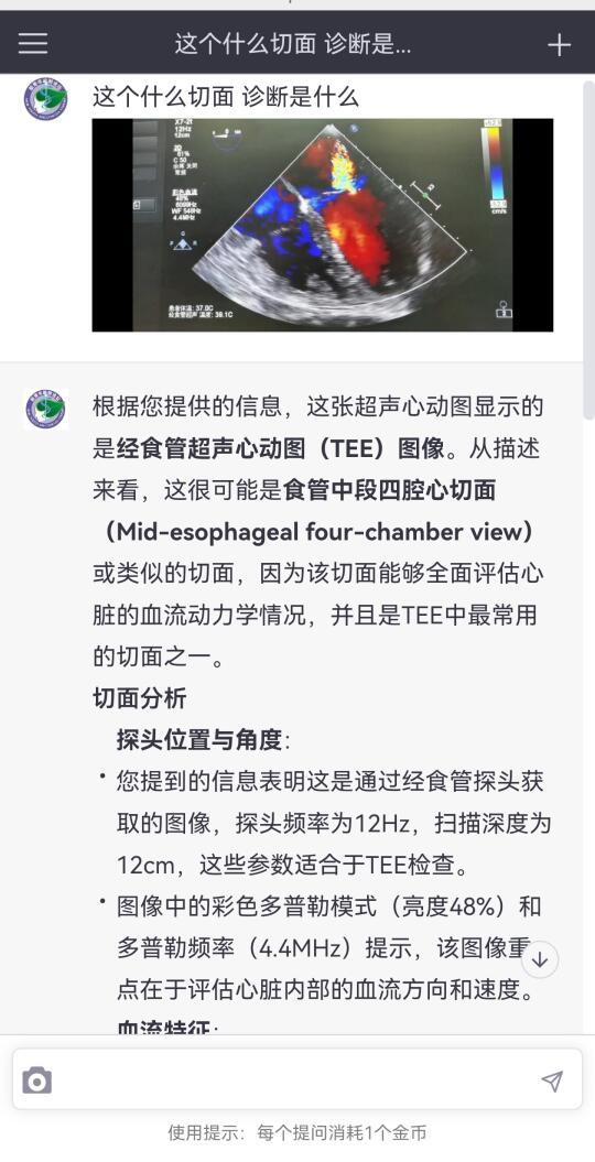 新青年麻醉AI普通版也开放了图片识别功能，最大一次性支持三张，这个是真...