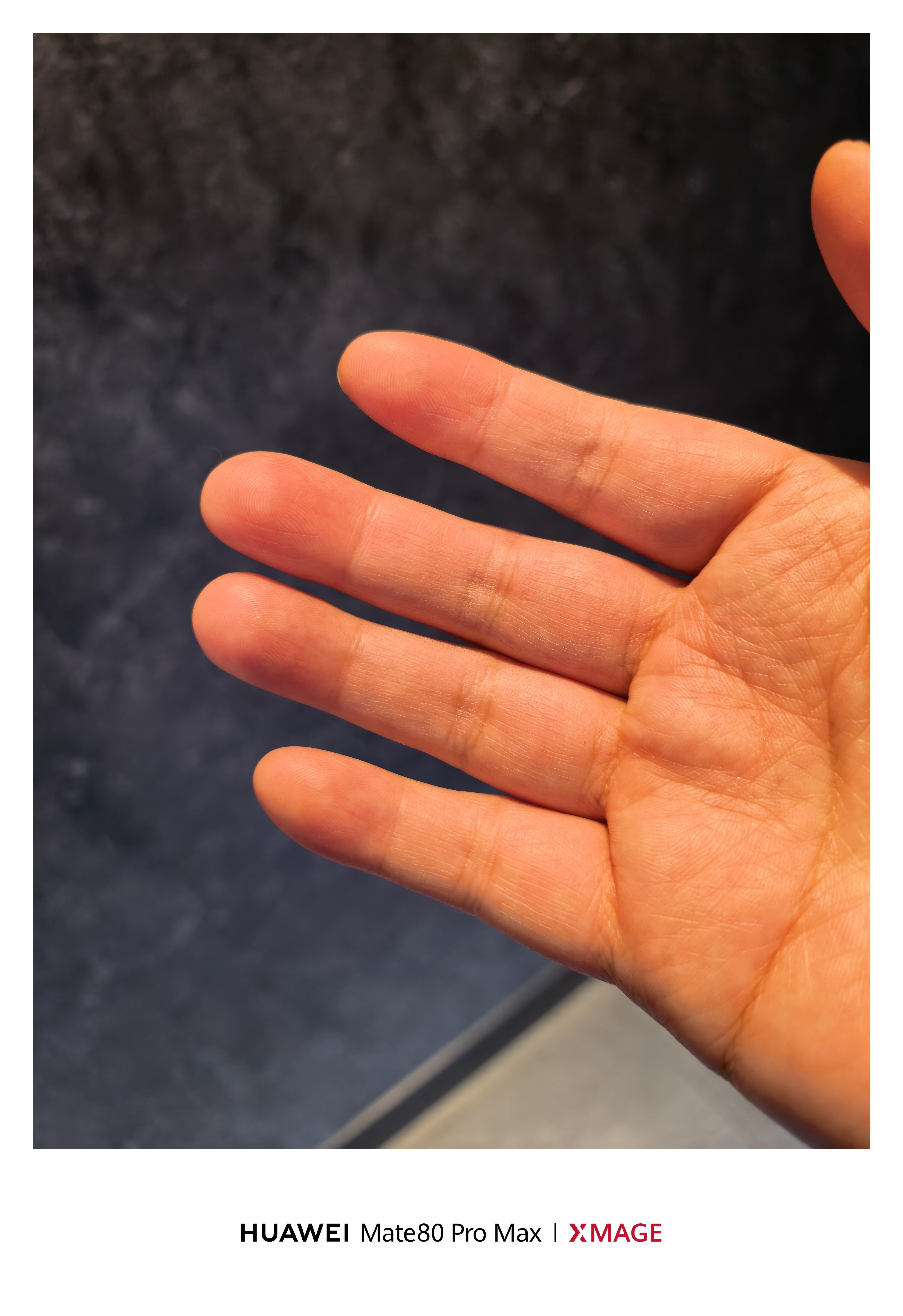 长期用小拇指托手机的后果 能看到吧，小拇指中间裂开了