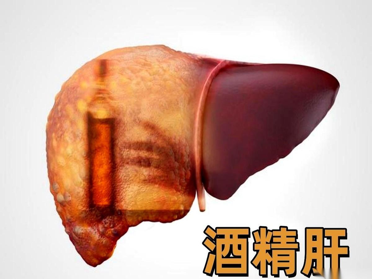 你晚上倒的那一小杯，以为是舒缓神经？
不，那是一份没有回声的加班通知，直接派给了