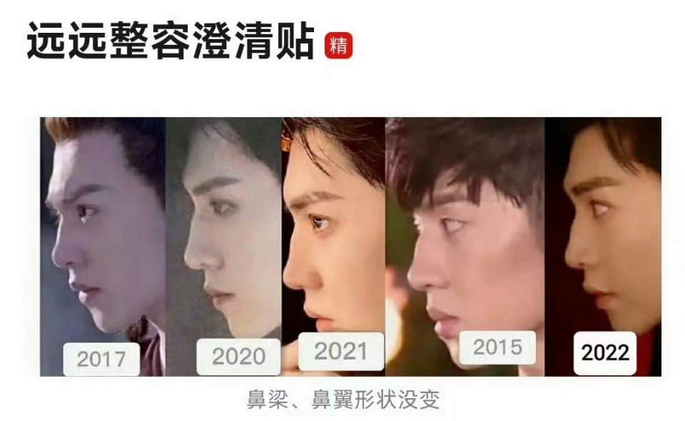 陈哲远整容澄清，看了一下鼻梁鼻翼确实是没变过啊[允悲]哪来的谣传[允悲] ​​​