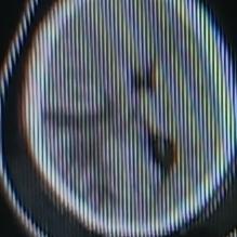 腔梗和脑梗虽都和脑部血管有关，但区别可不小。先说腔梗，它全称腔隙性脑梗塞，病灶小