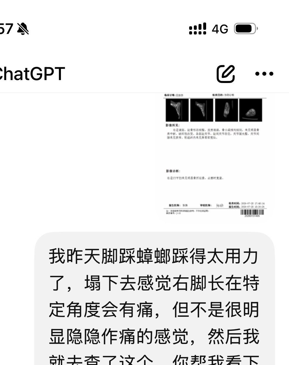 谁能想到，踩蟑螂（吓它，让它赶紧走），用力太大，会需要拍片呢 
