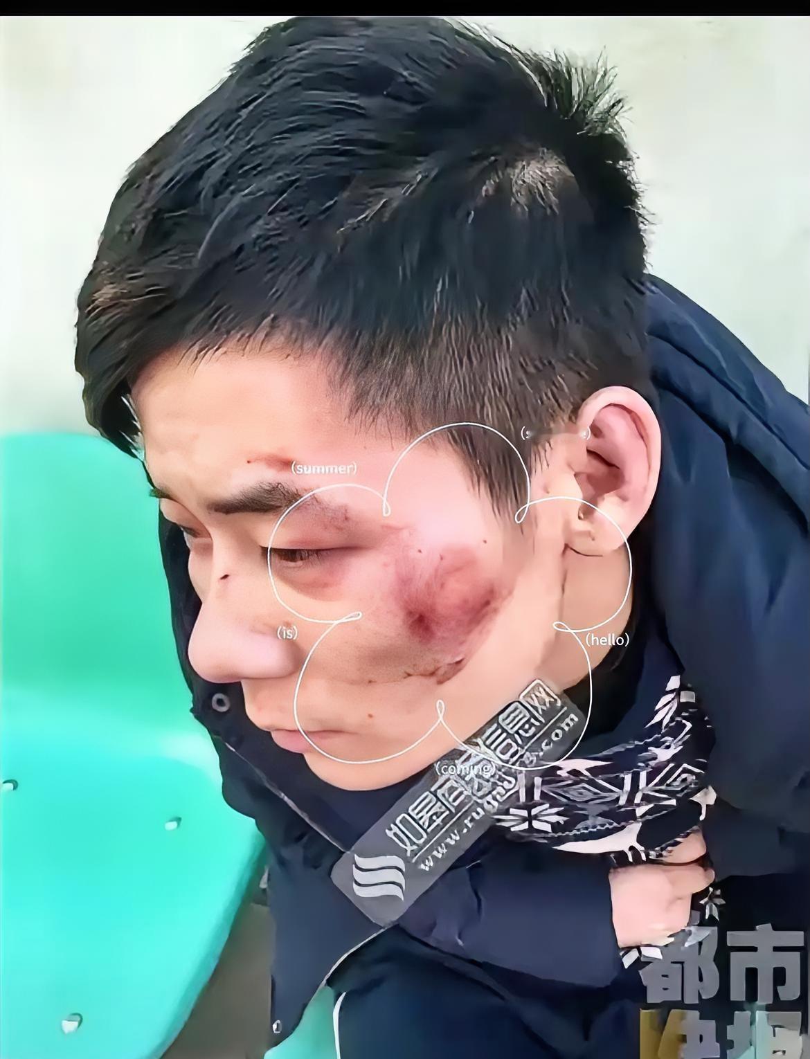 大半夜被人追打，直接往武警营门跑。
​这哥们儿算是把“绝境求生”玩明白了。
​5