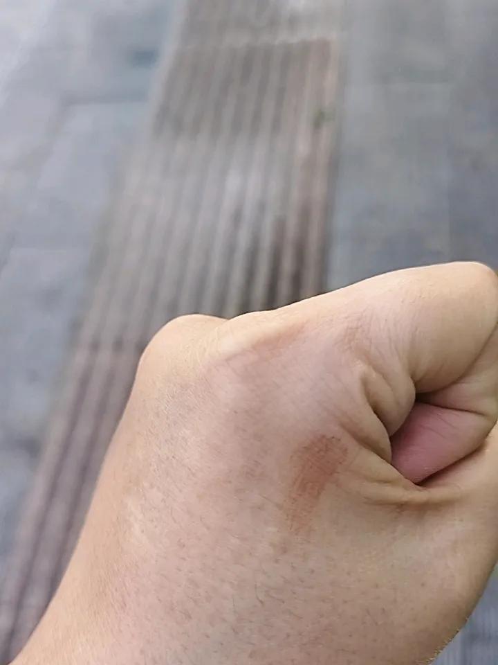 大清早便与蚊子结了缘。原本没觉得手痒，只是随意看了一眼，竟发现有只“喝饱了的家伙