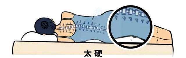 #健康真探社#【睡硬板床不能治腰椎间盘突出！】腰椎间盘突出了，要不要治？怎么治？