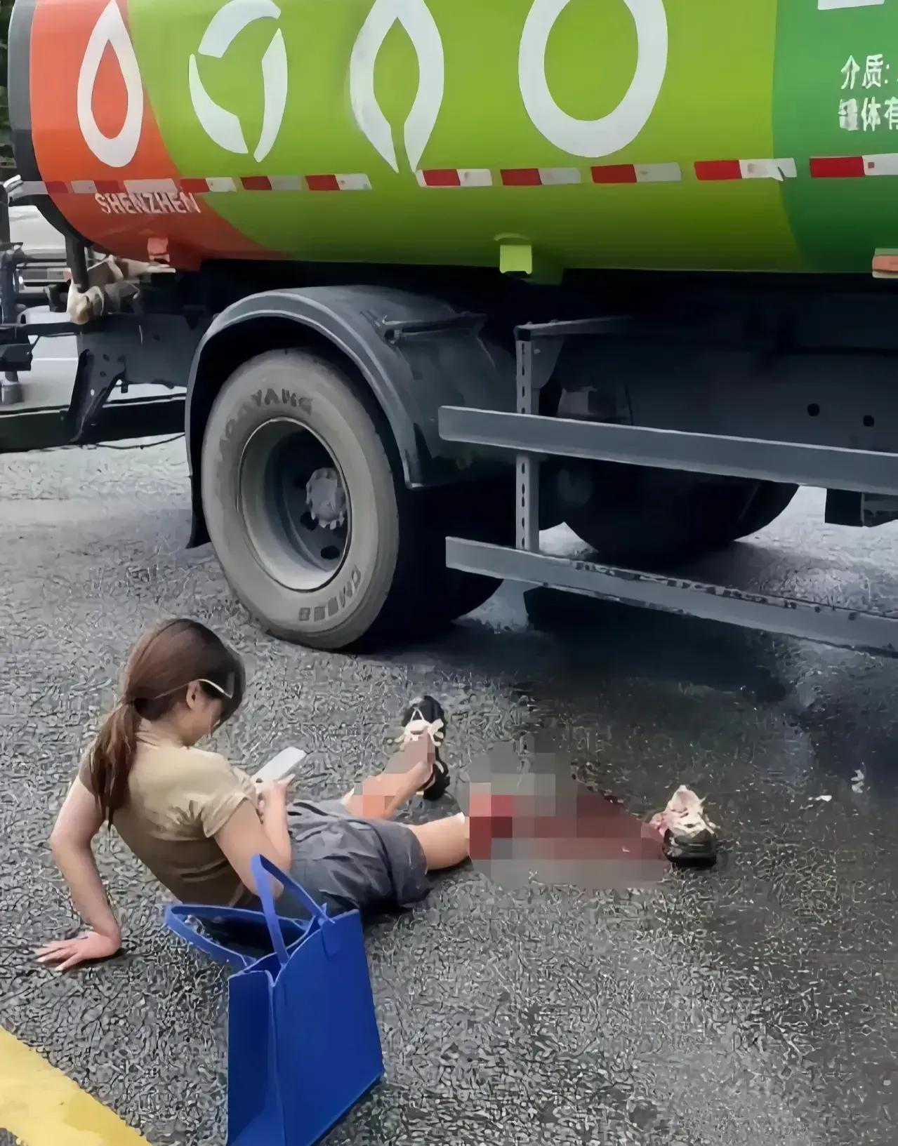 这女生不知道疼吗？拿着手机自己还玩了起来