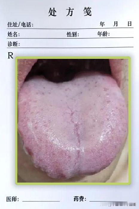24岁小伙初体验，云雨不停，夜夜笙歌，结果晨起没了，二弟还有疼痛感！

我们来看