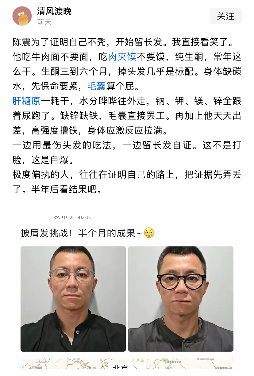网友也是闲的慌，开始关注陈震掉不掉头发😆 ​​​