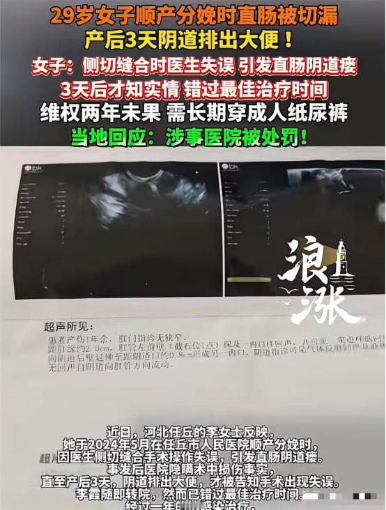 “太坑人了”河北任丘，29岁女子在某医院顺产生娃，3天后，突然在阴道里排出大便，