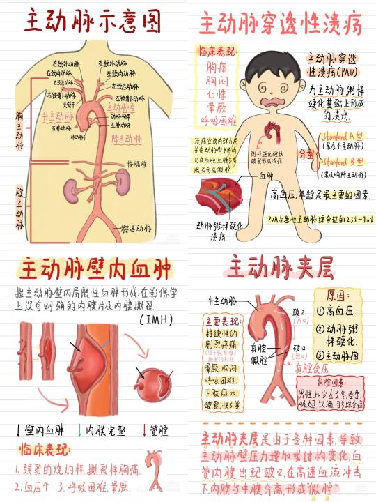 主动脉急性综合征（共8张）