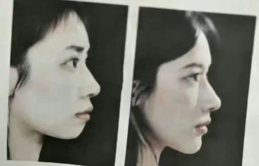 这哪是整牙的变化啊，这简直像是换了一个人 