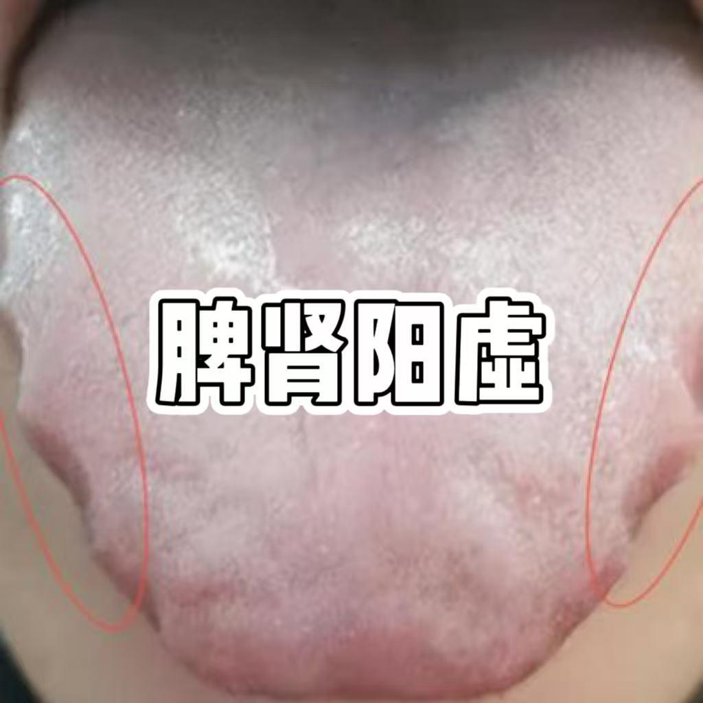 它比金匮肾气强百倍，阴阳双补，脾肾同调，关键还不上火！

很多人一怕冷、腰酸、没