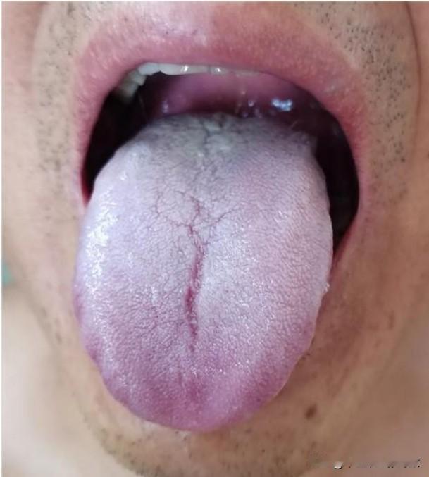 最后再说一遍，管住嘴，管住嘴，不然谁也没用[吃瓜群众][吃瓜群众][吃瓜群众]
