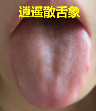 长寿第一步在于养肝！中医教你如何选择逍遥、柴胡、丹栀逍遥这三个养肝名方！

1、