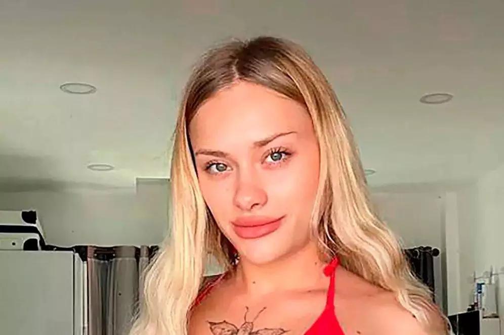 乌克兰女模特的遭遇真是太惨了，参加私人派对，脸被划开，头发被剪掉，扔在路边。之前