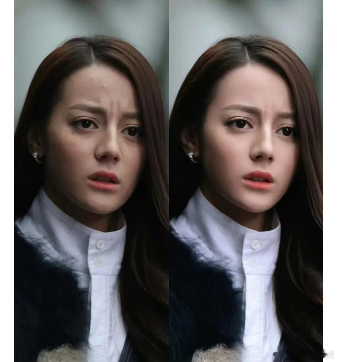 迪丽热巴的皮肤状态是不是一直以来都挺堪忧的？ ​​​