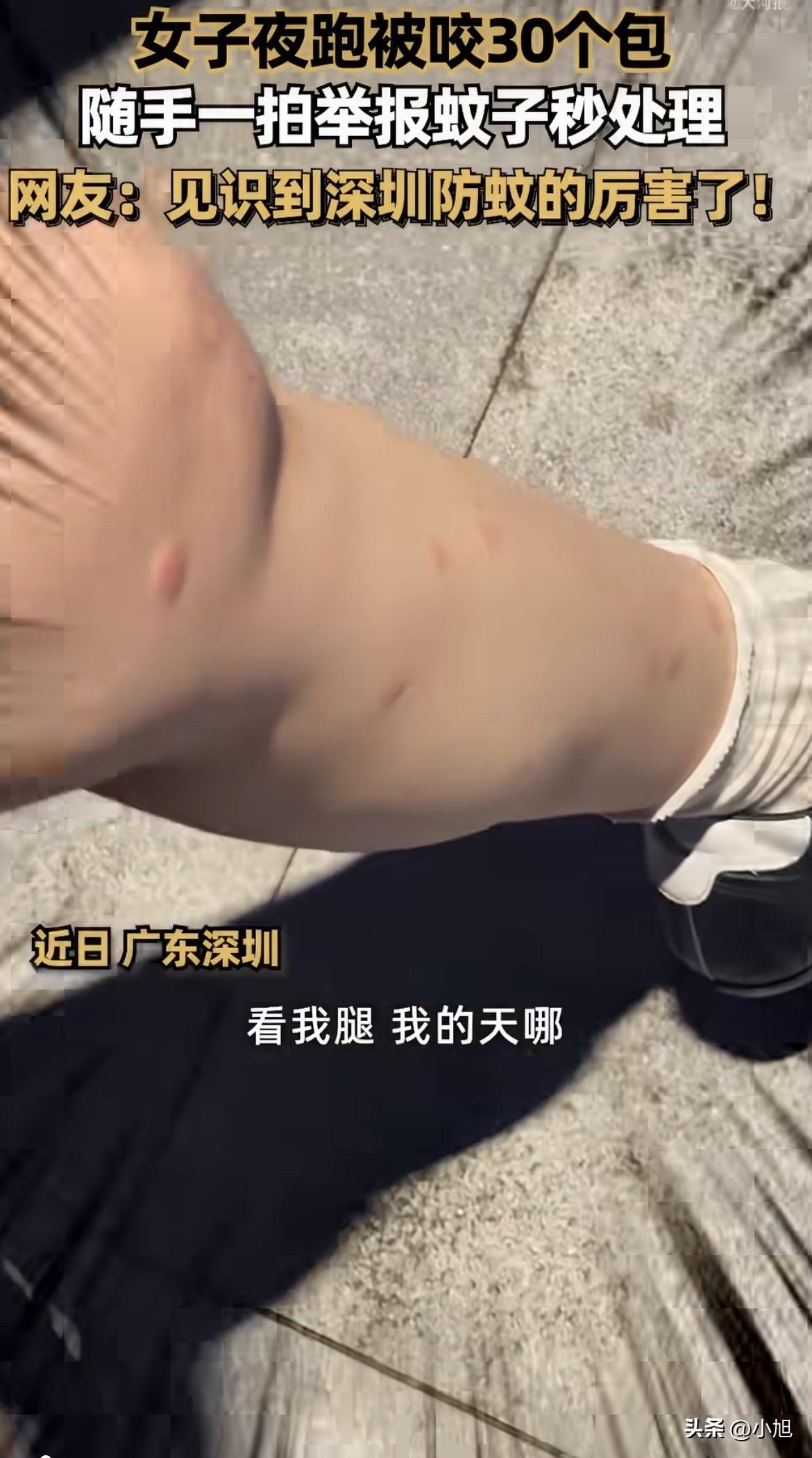 深圳有个女的叫小曹，夜跑回来身上痒得不行。她男朋友闲着没事，帮她数蚊子包。数到第