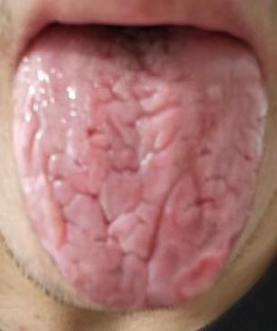 肾精耗伤别盲目进补，平调阴阳养元气更科学






由于年少无知伤精过度，如今