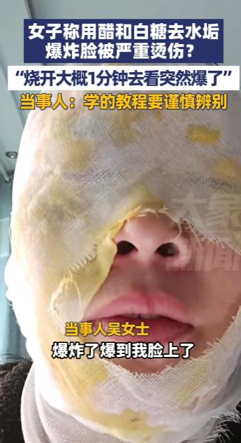 “悲剧还是发生了！”10月7日，河北邯郸，一女子根据网上“教程”将醋和白糖煮开去