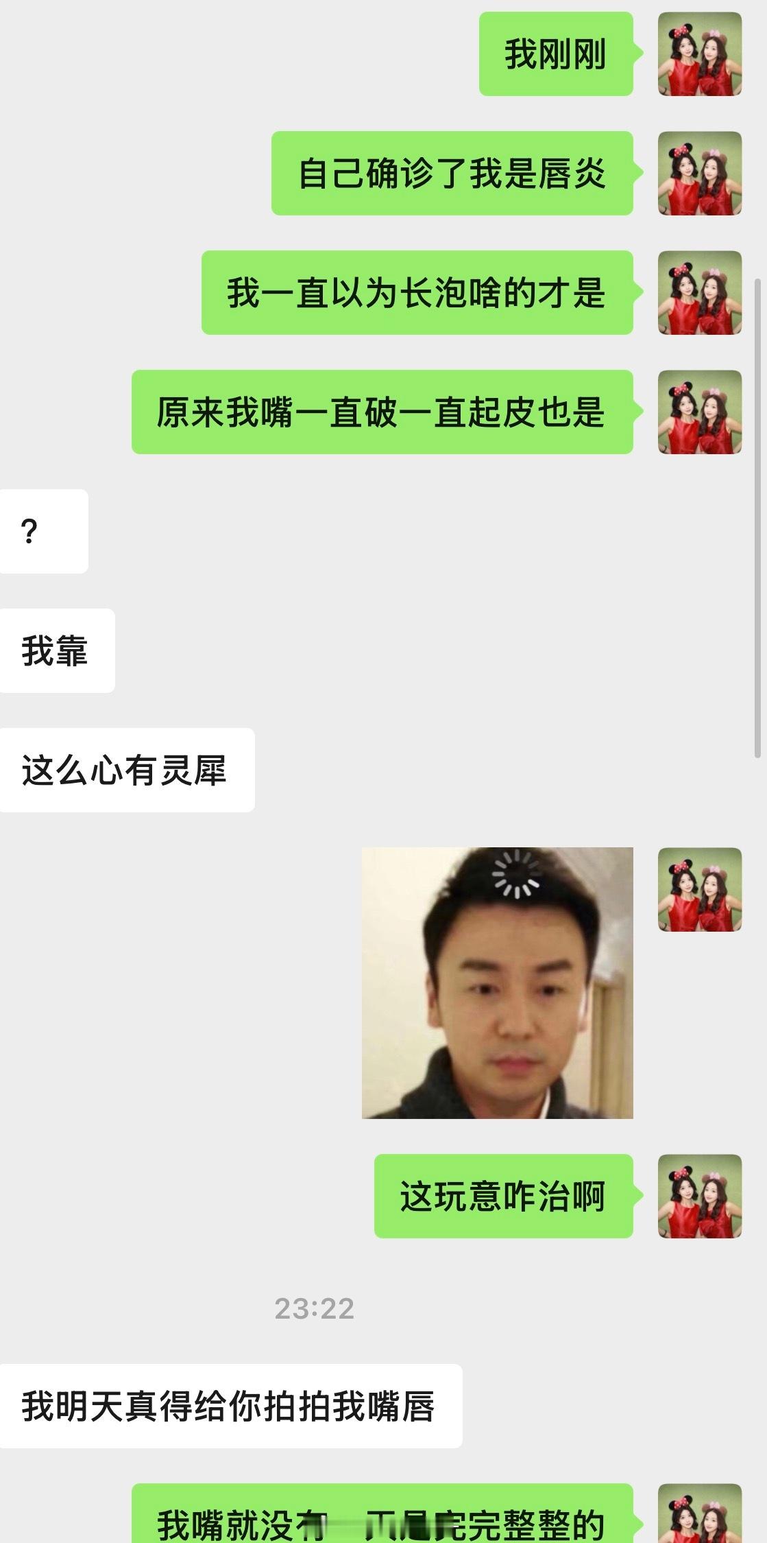 原来这是唇炎啊 我还以为我单纯喝水少