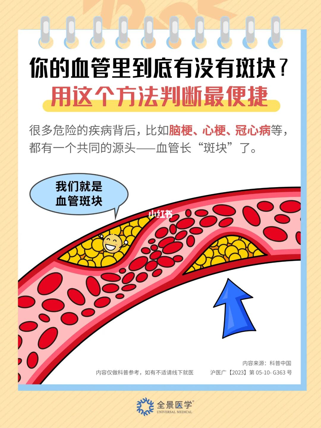 你的血管里到底有没有斑块？用这个方法看❗